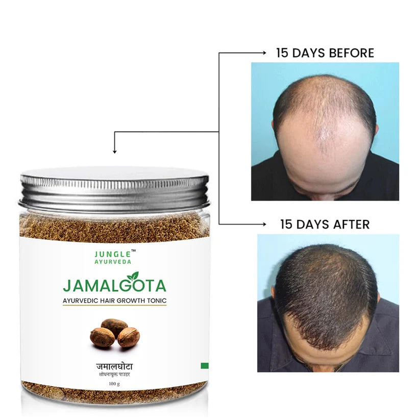 Jamalgota™ - Ayurvedic Hair Growth Powder - (Buy 1 Get 1 FREE🔥🔥)